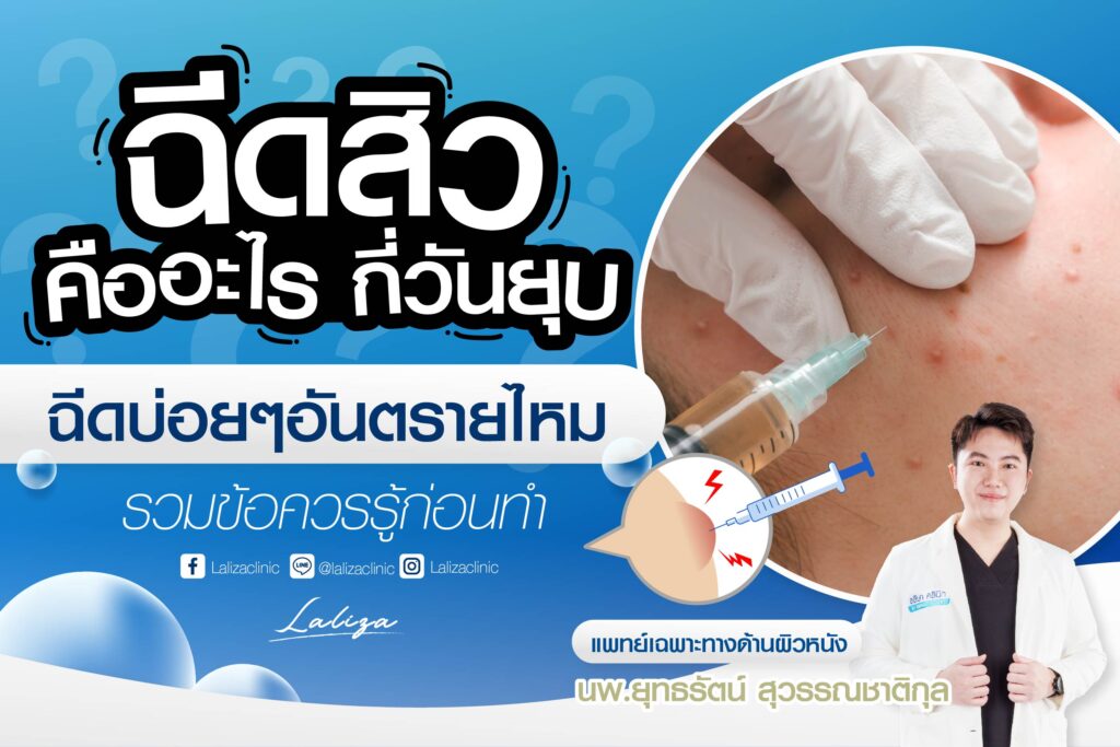 ข้อมูลการฉีดสิว คืออะไร เหมาะกับใคร โดยแพทย์ผิวหนัง