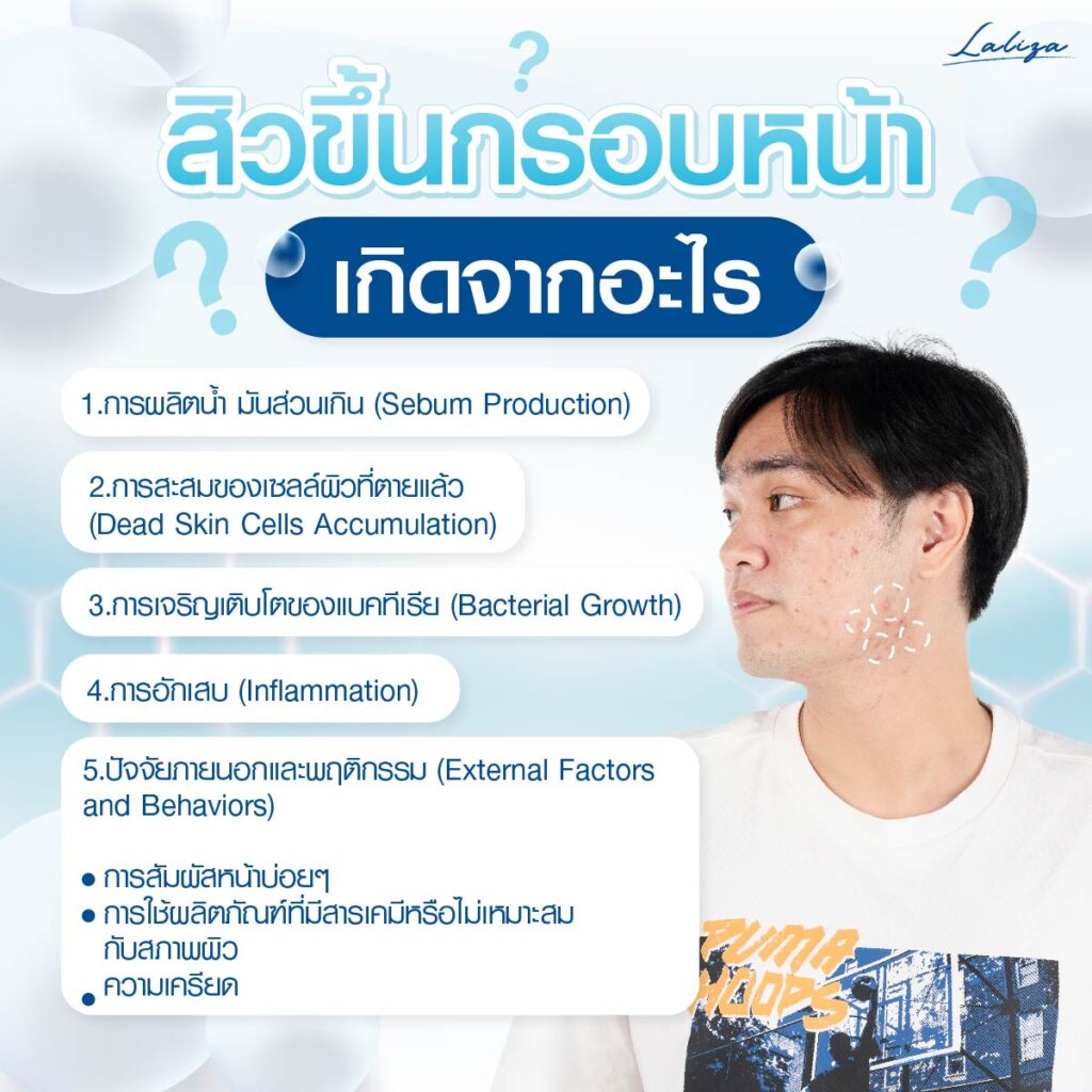 สาเหตุของการเกิดสิวกรอบหน้า