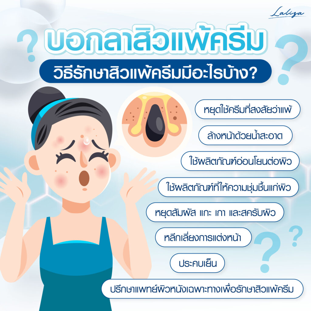 สิวแพ้ครีมรักษาอย่างไร