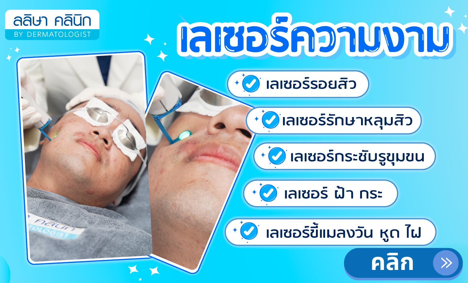 บริการเลเซอร์ความงาม