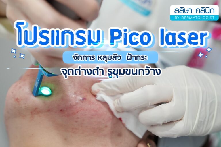 picolaser คืออะไร กี่ครั้งเห็นผล