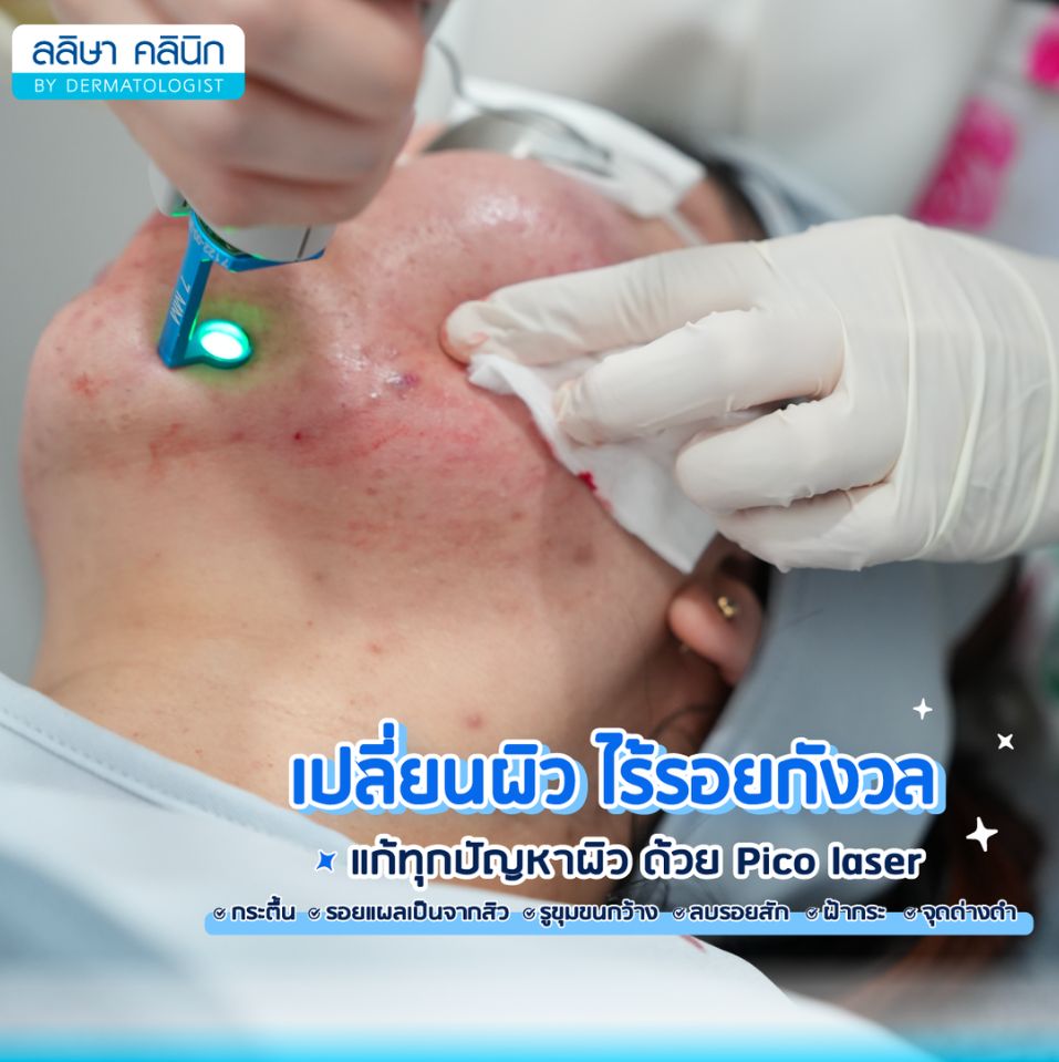 picolaserช่วยเรื่องอะไร