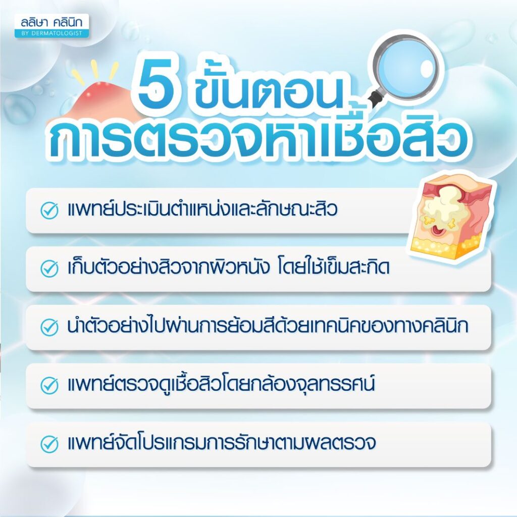 ขั้นตอนการตรวจหาเชื้อสิว