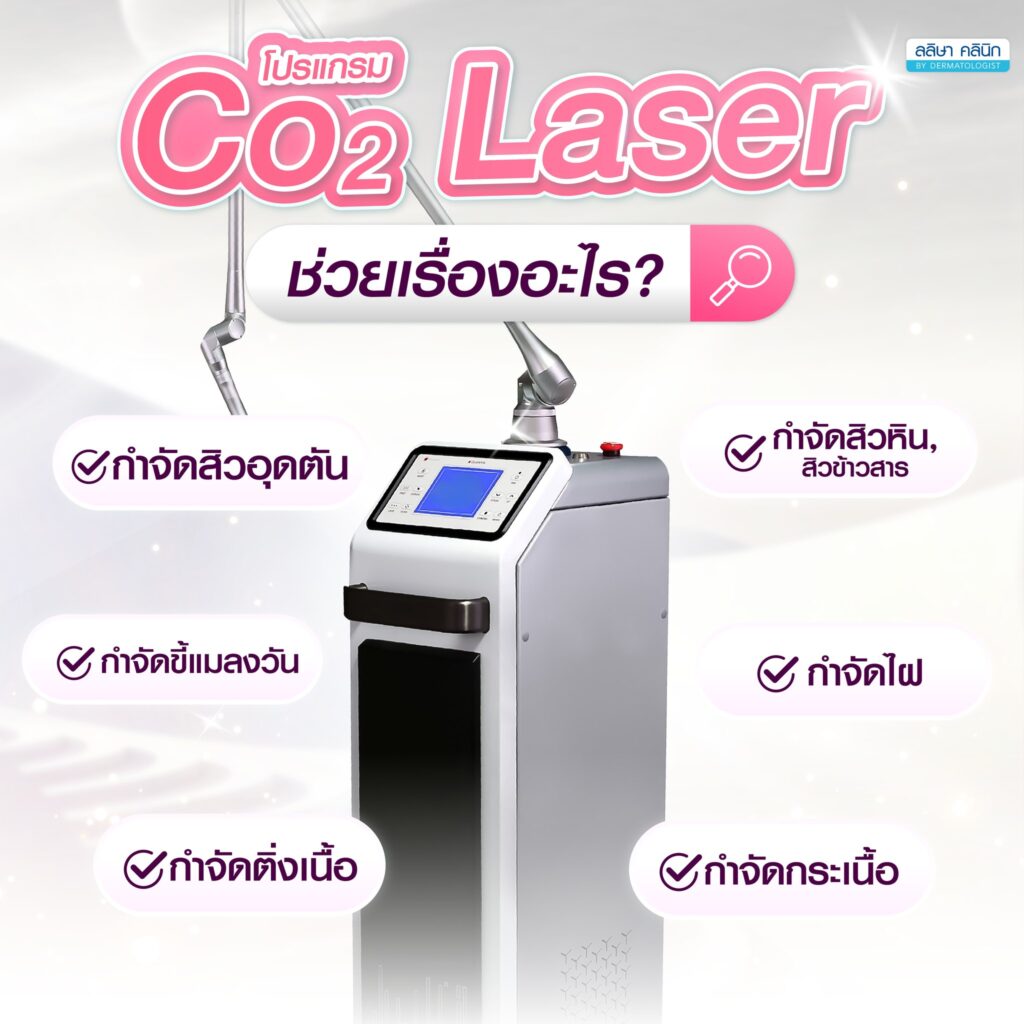 co2 laser