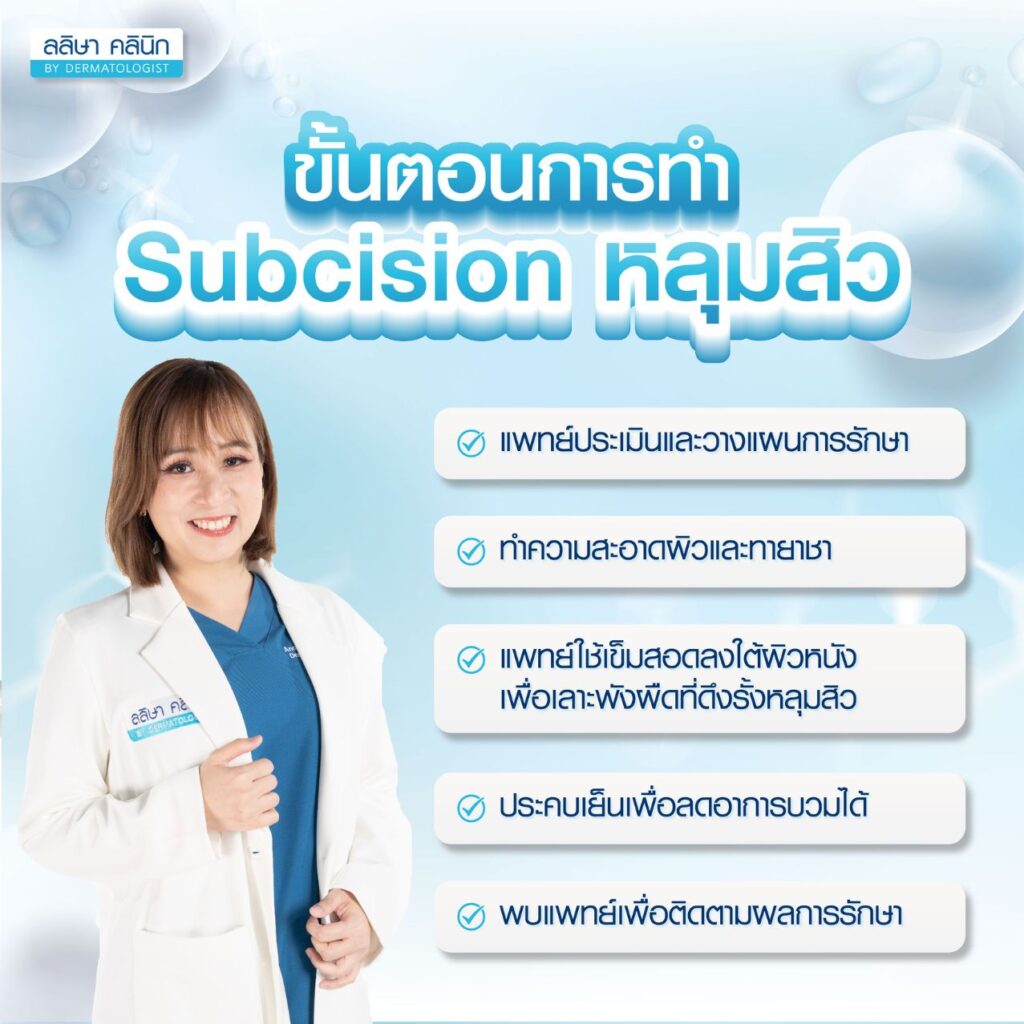 ขั้นตอนการทำ Subcision