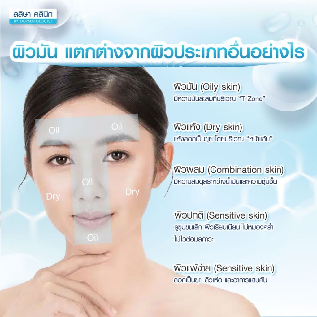 ผิวหน้ามันต่างจากผิวประเภทอื่นอย่างไร