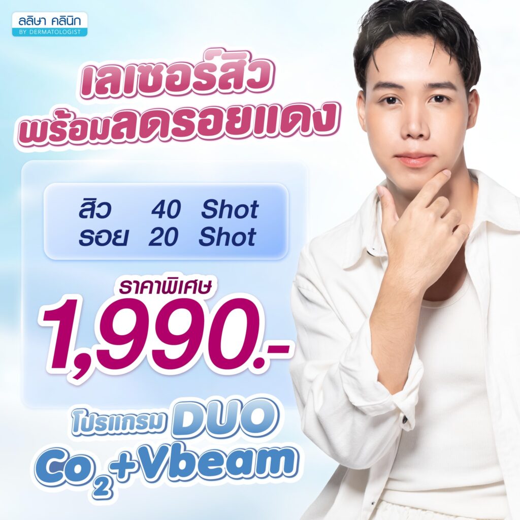 ราคาเลเซอร์สิวโปรโมชั่นพิเศษ