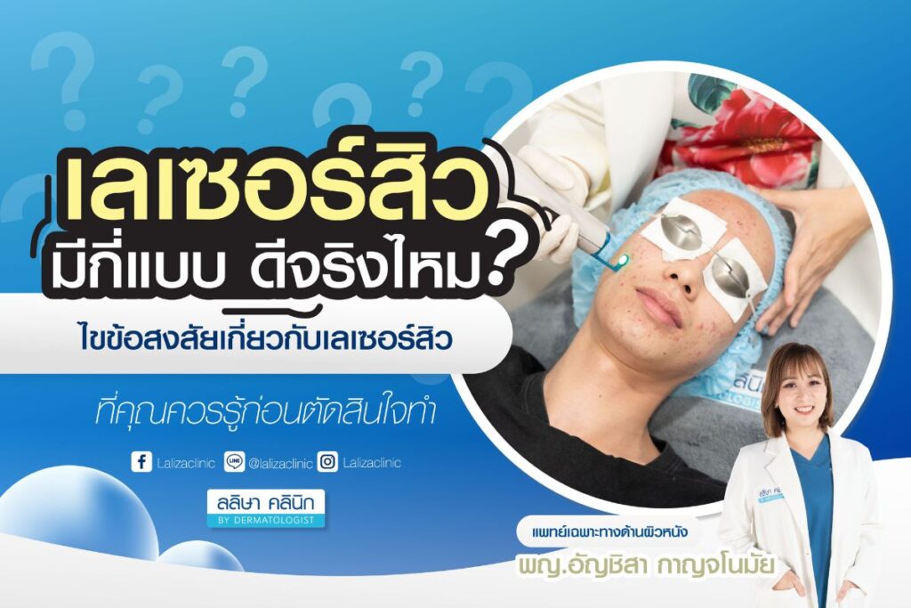 เลเซอร์สิว ดีจริงไหม? ไขข้อสงสัยเกี่ยวกับlaser สิวที่คุณควรรู้ก่อนตัดสินใจทำ