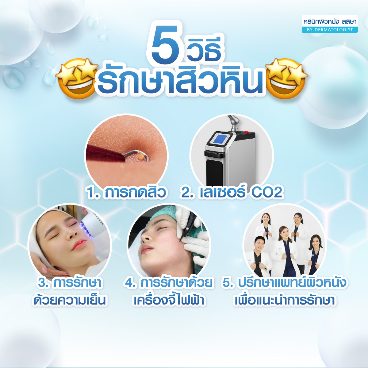5 การรักษาสิวหิน