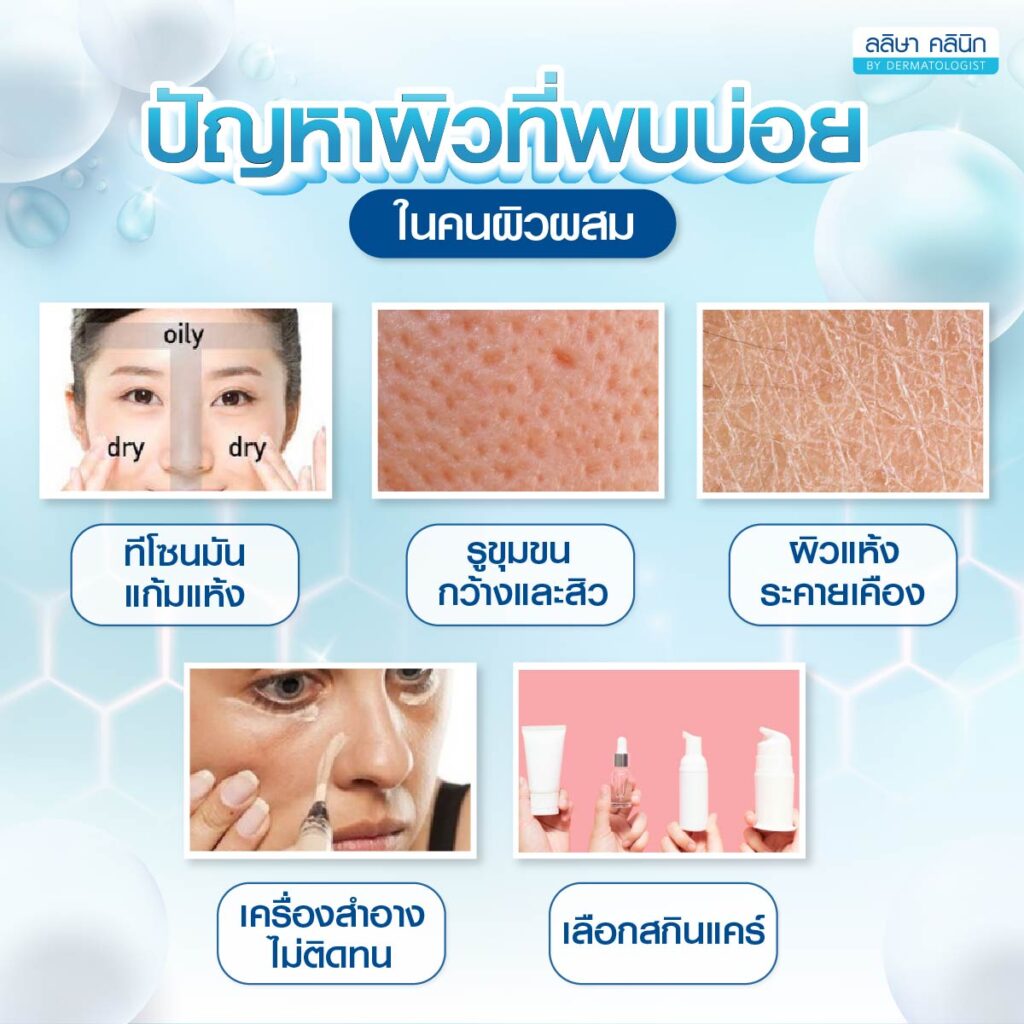 ปัญหาของคนมีผิวผสม