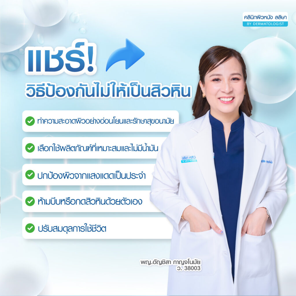 ป้องกันสิวหิน