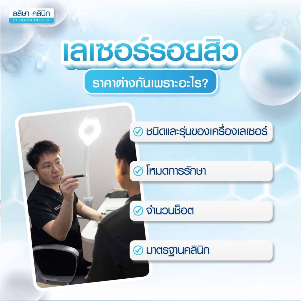 เลเซอร์รอยสิวราคาต่างกัน