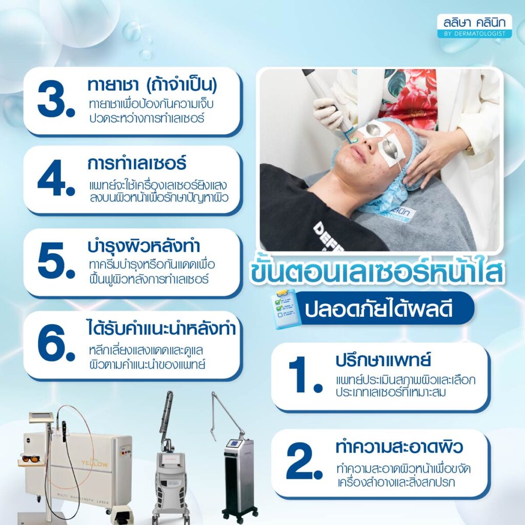 ขั้นตอนทำเลเซอร์หน้าใส