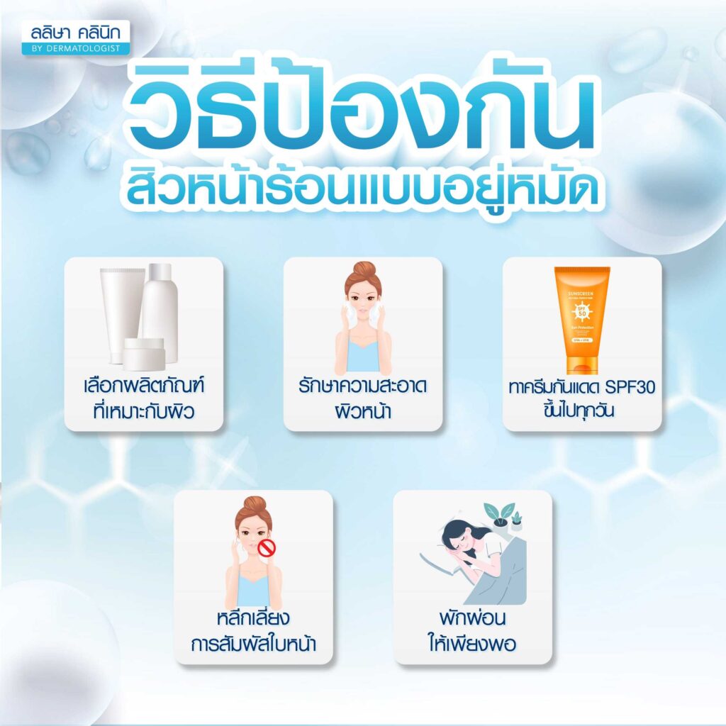 วิธีป้องการเกิดสิวในช่วงหน้าร้อน