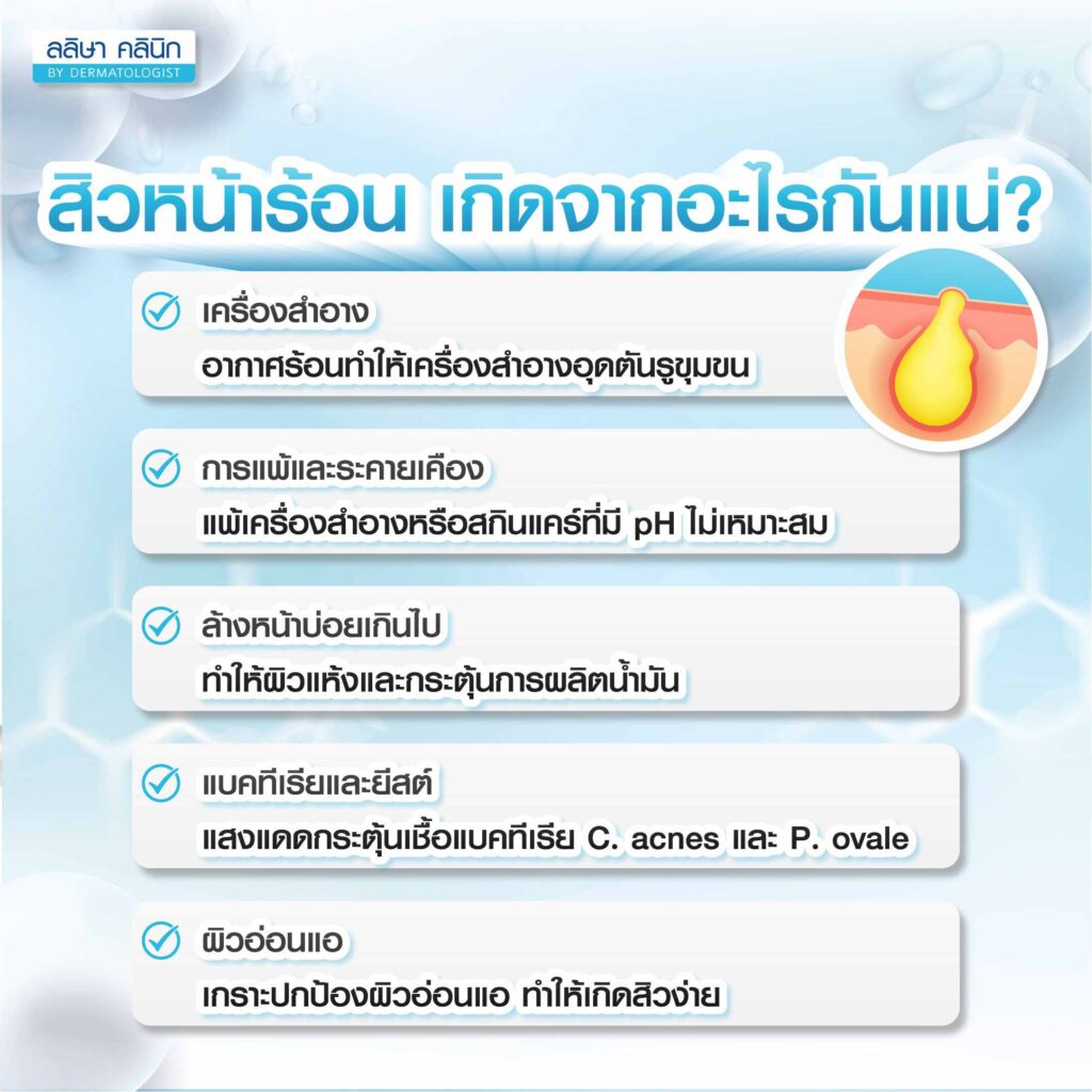 สิวในหน้าร้อนเกิดจาก
