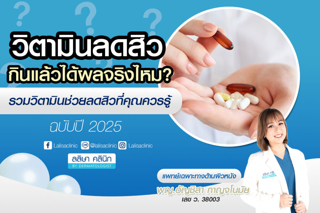Acne reducing vitamins
