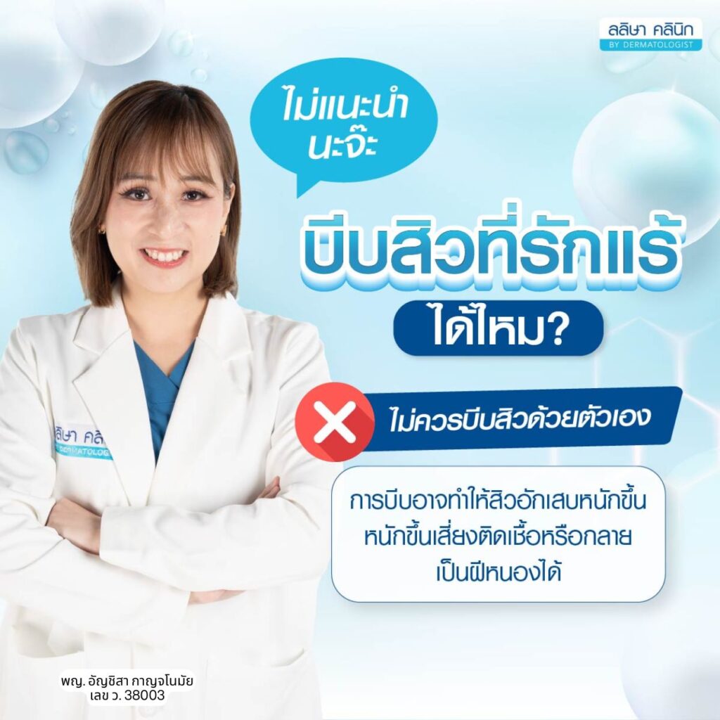ข้อแนะนำการบีบสิวที่รักแร้