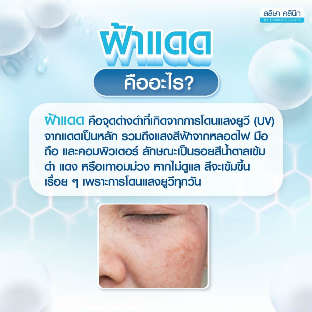 ความหมายฝ้าแดด