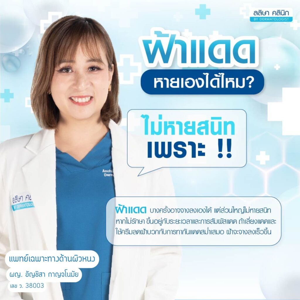 ฝ้ายแดดหายเองได้ไหม