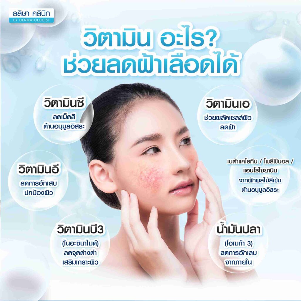 วิตามิน ช่วยแก้ฝ้าเลือด