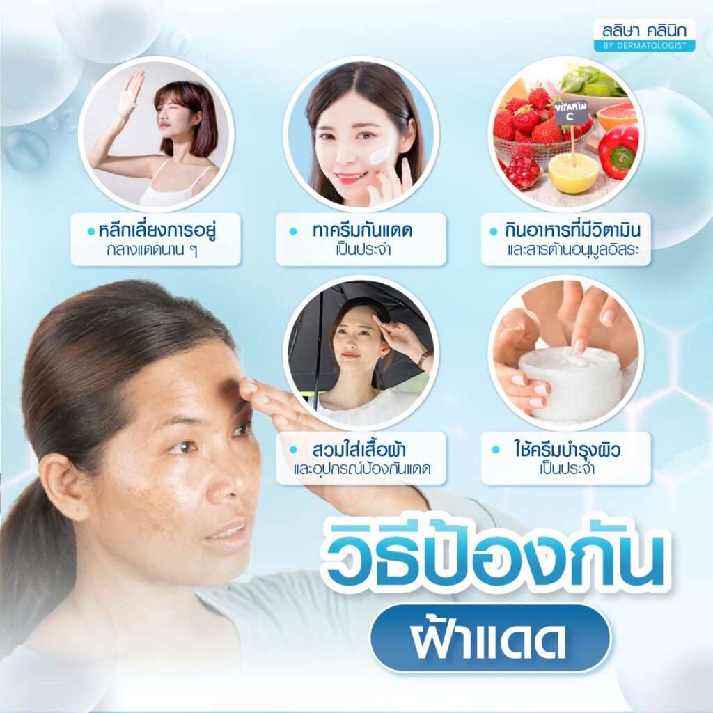 วิธีป้องกันฝ้าแดด