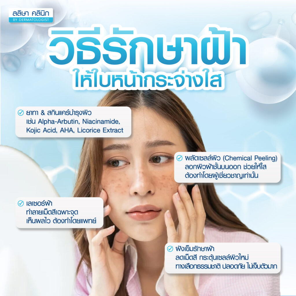 วิธีรักษาฝ้า