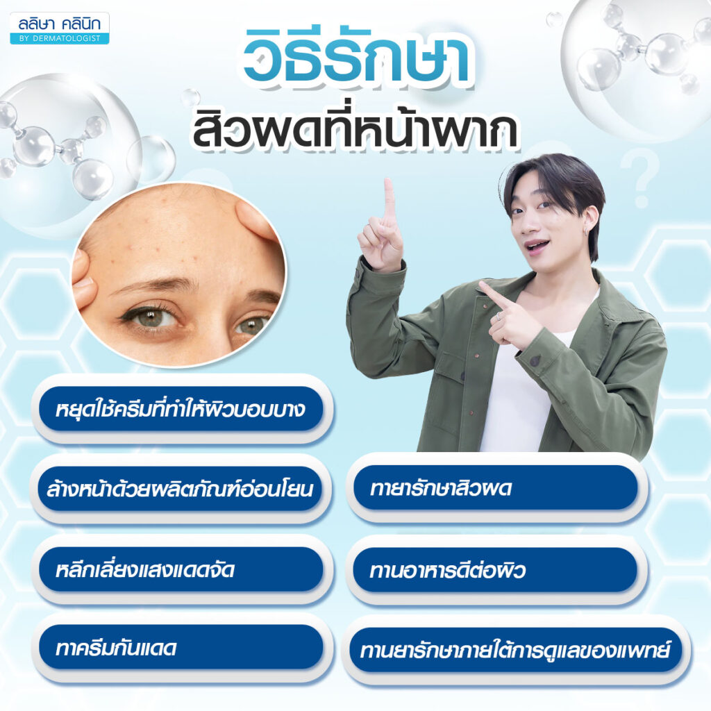 วิธีรักษาสิวผดที่หน้าผาก