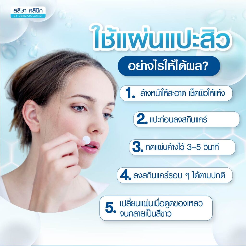 วิธีใช้แผ่นแปะสิว