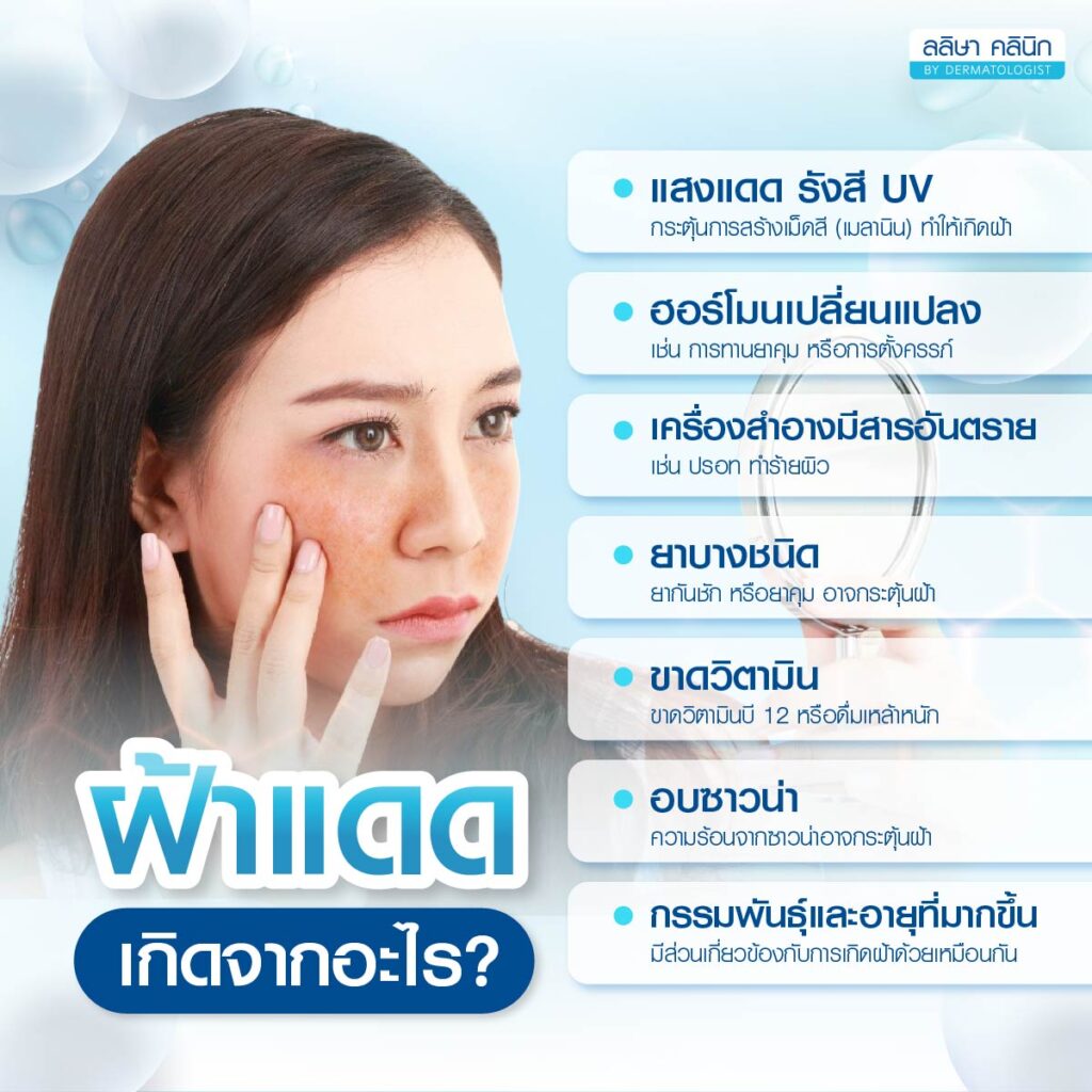 สาเหตุฝ้าแดด