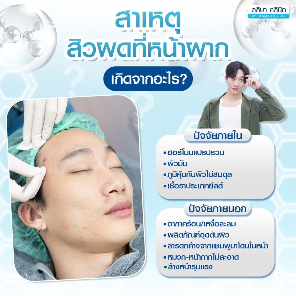 สาเหตุสิวผดที่หน้าผาก