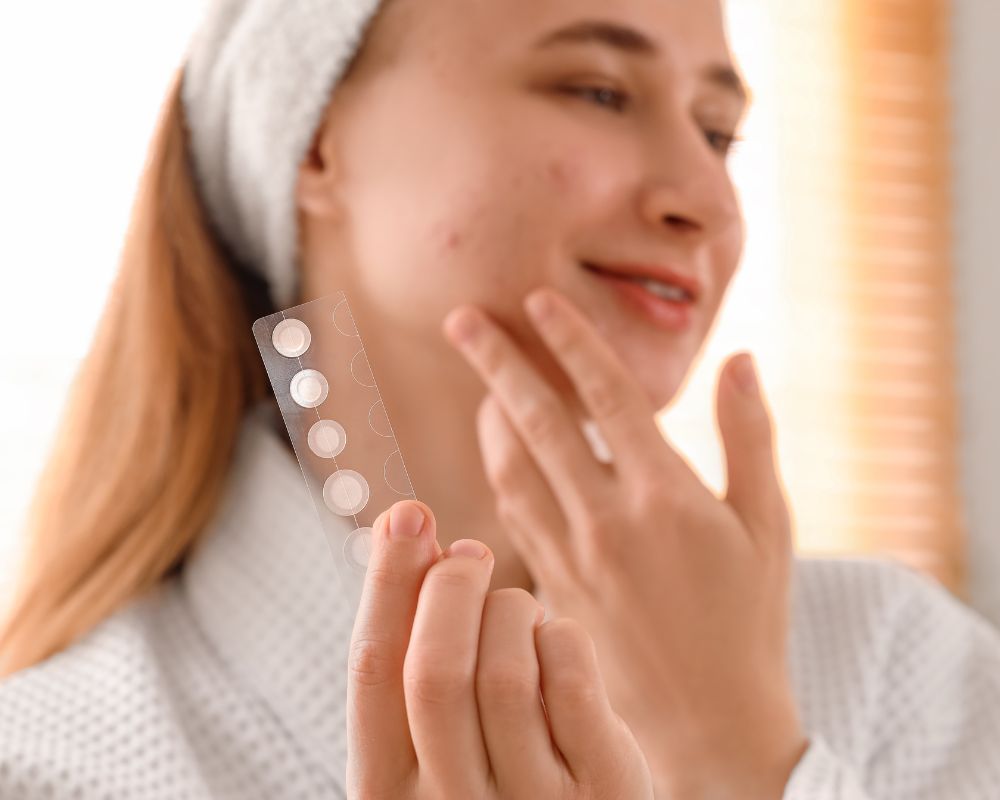 สิวที่เหมาะกับการใช้แผ่นแปะสิว