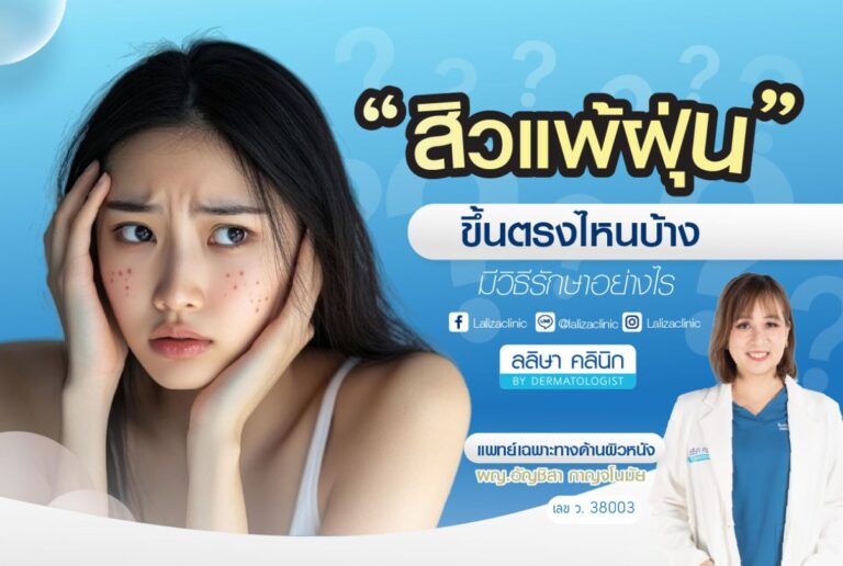 สิวแพ้ฝุ่น ขึ้นตรงไหน และวิธีรักษา
