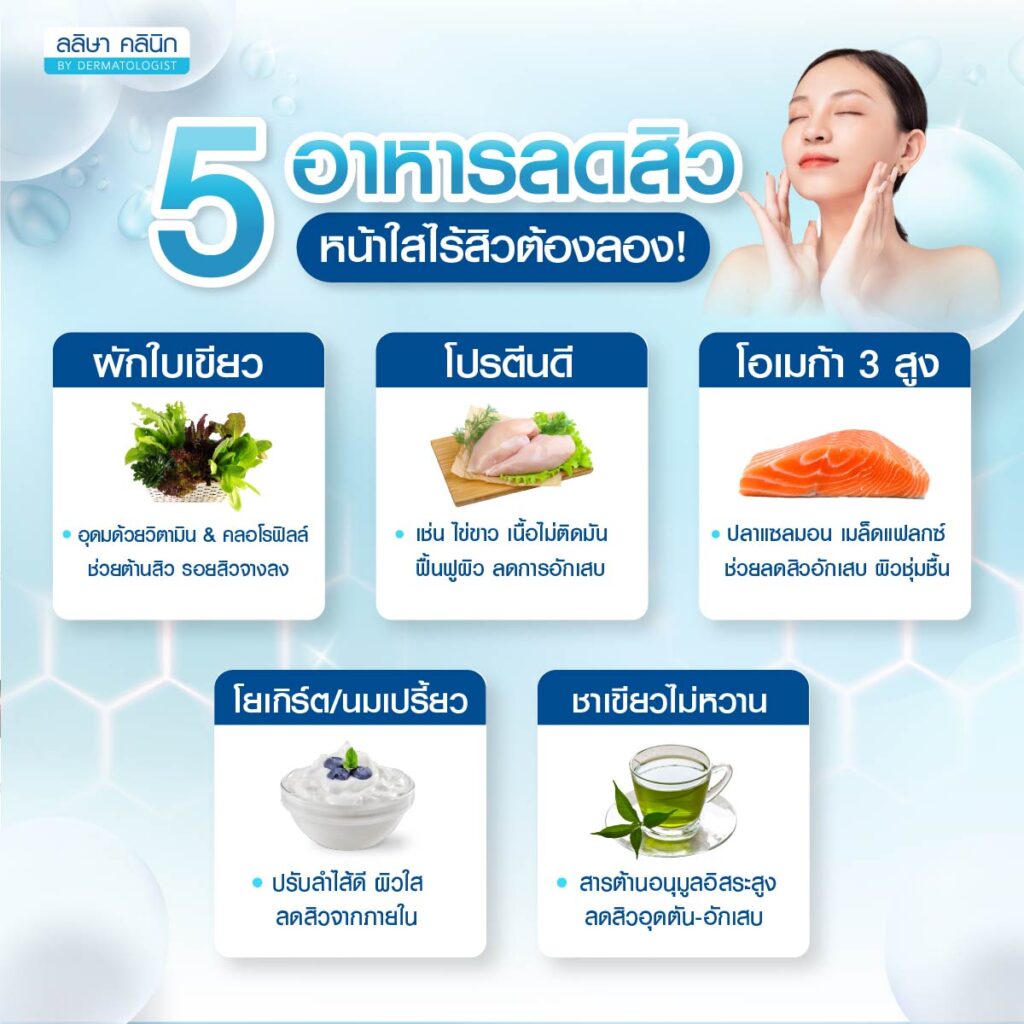 5 อาหารลดสิว