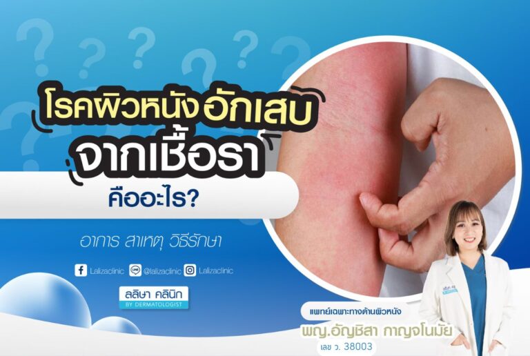 Fungal dermatitis