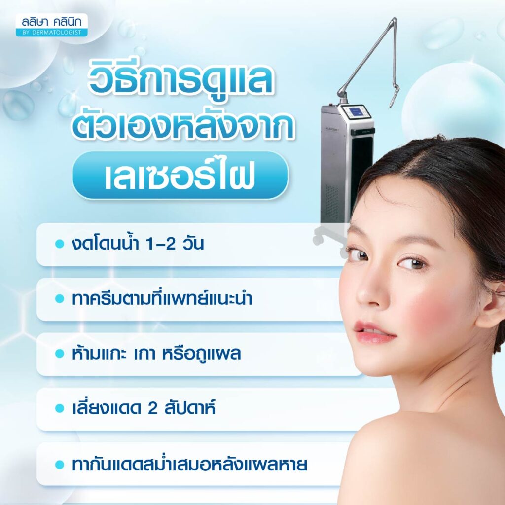 การดูแลตัวเองหลังทำ