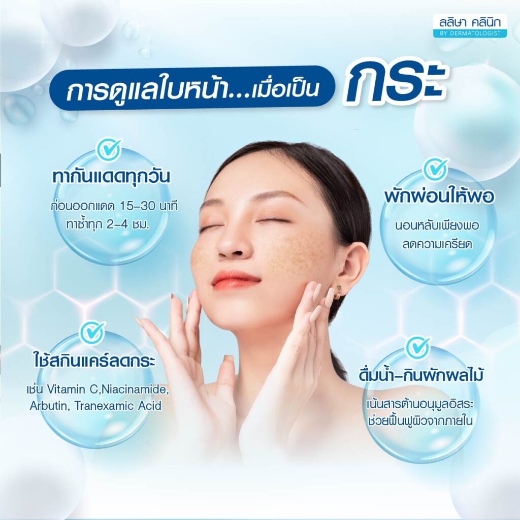 การดูแลเมื่อเป็นกระก่อนออกแดดประมาณ 15-30 นาที