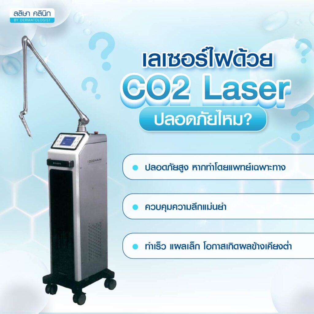 กำจัดไฝด้วยเลเซอร์3