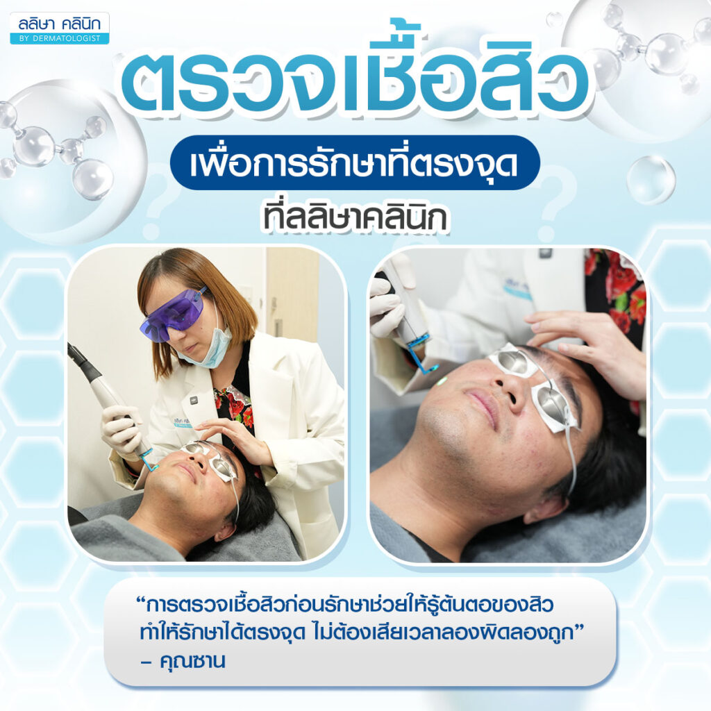 ตรวจเชื้อสิว ขั้นตอนสำคัญ เพื่อการรักษาที่ตรงจุด ที่ ลลิษา คลินิก_