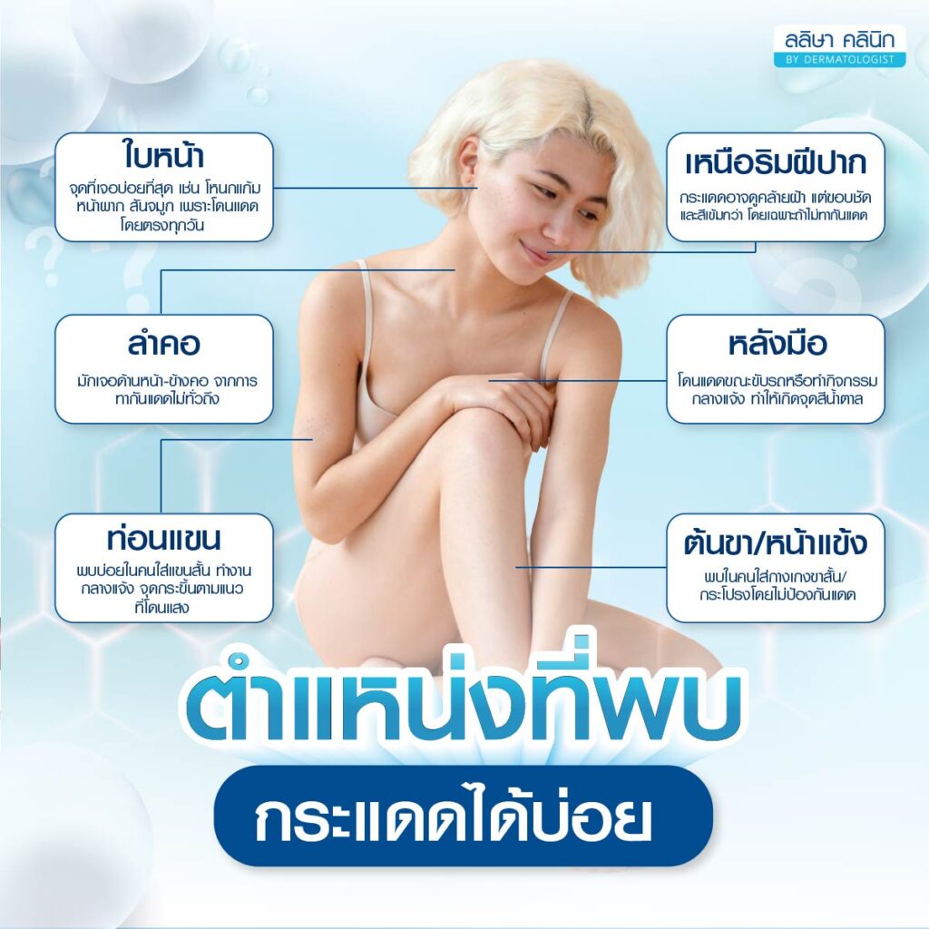 ตำแหน่งที่มักจะพบกระแดด