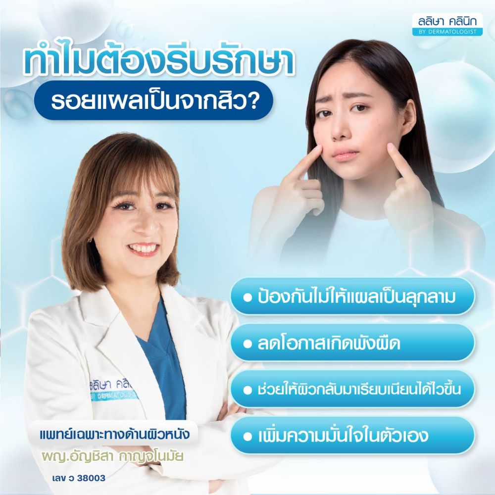 ทำไมต้องรีบรักษารอยแผลเป็นจากสิว
