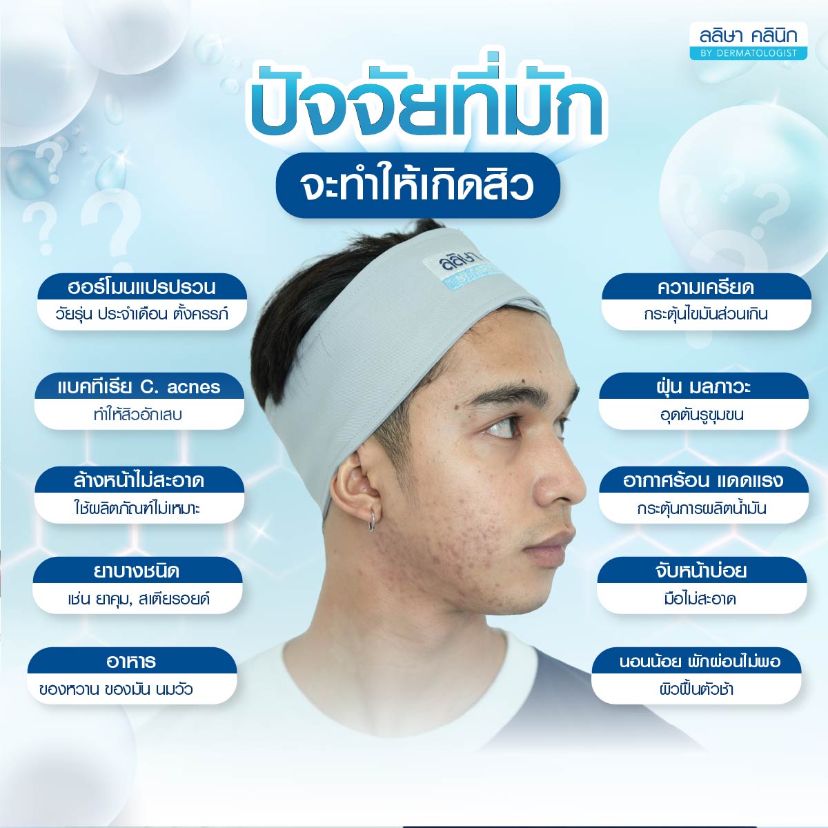 ปัจจัยที่ทำให้เกิดสิว