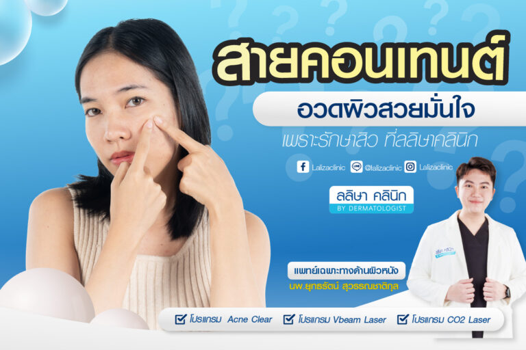 รีวิวคุณบิว Content Creator รักษาสิว