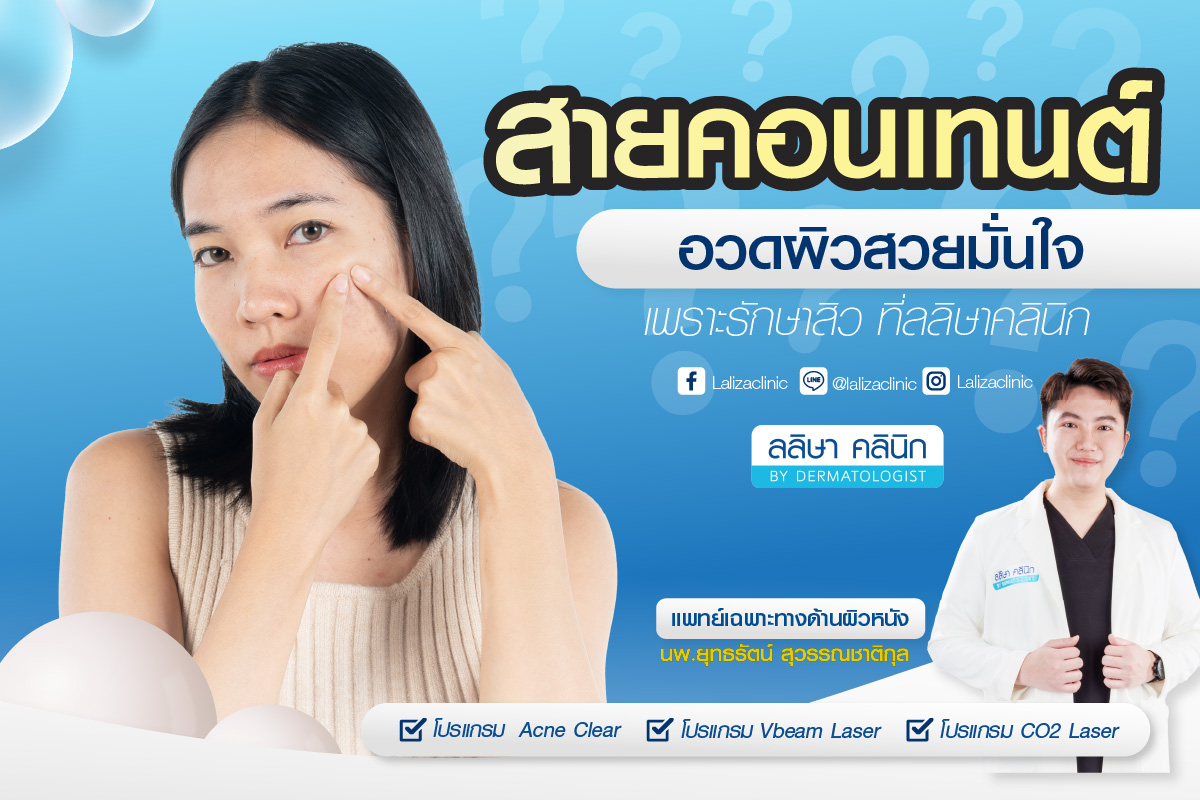 รีวิวคุณบิว Content Creator รักษาสิว