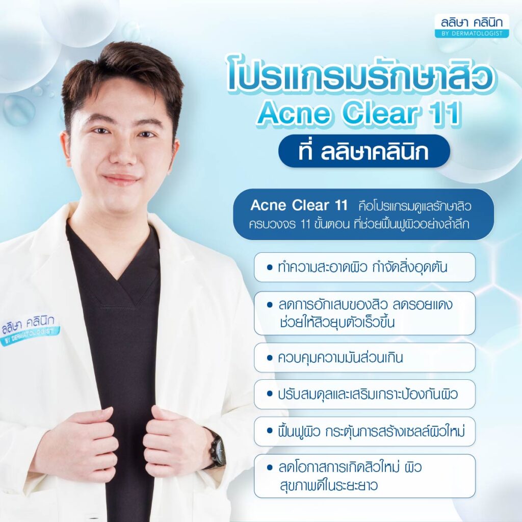รีวิวคุณแก้ม