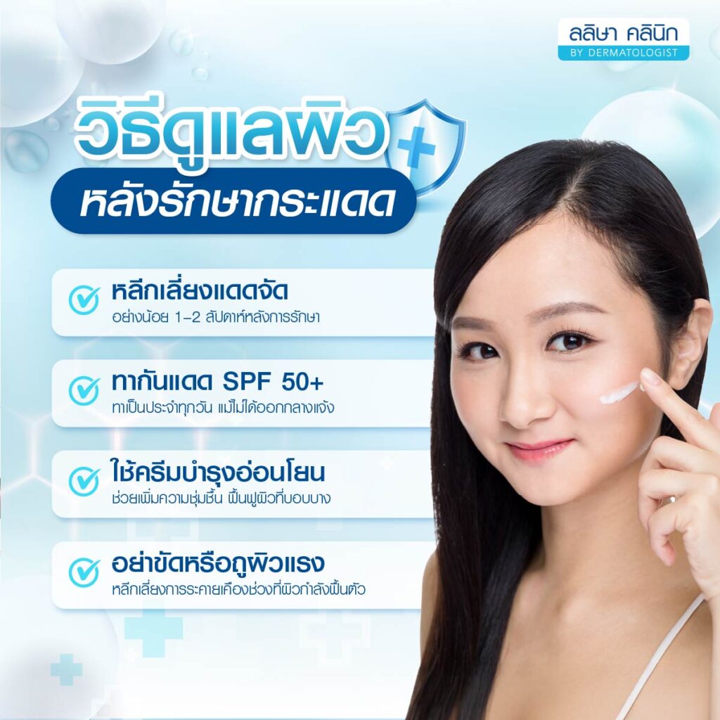 วิธีดูแลผิวหลังรักษากระแดด