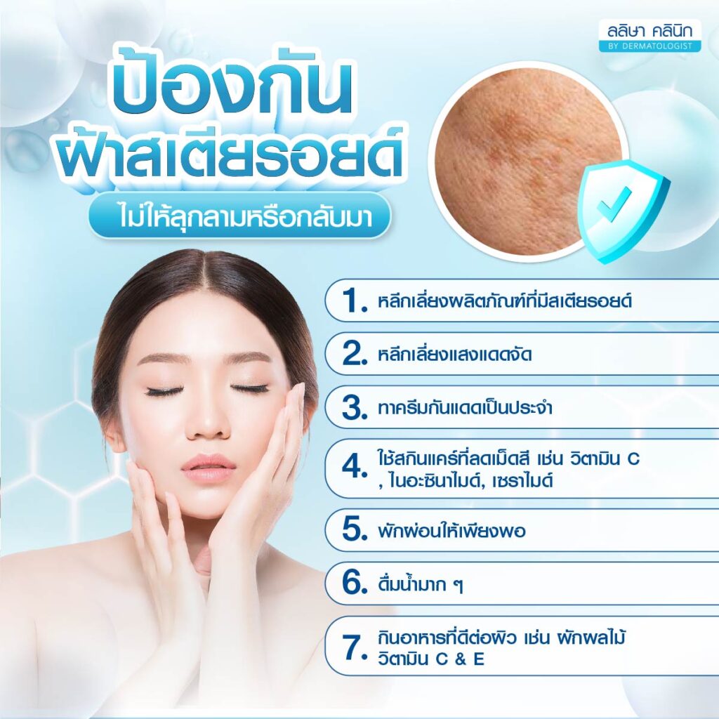 วิธีป้องกันฝ้าสเตียรอยด์