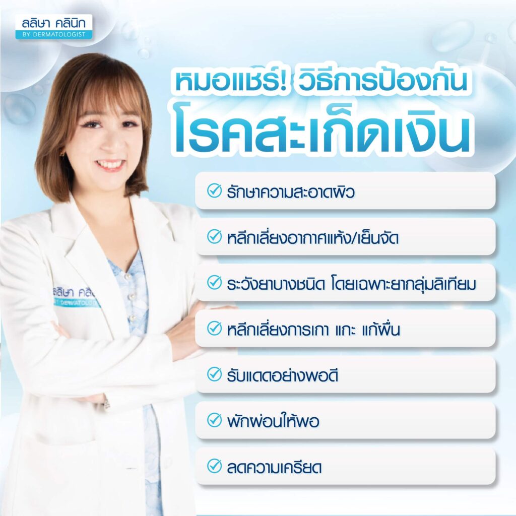วิธีป้องกันโรคสะเก็ดเงิน