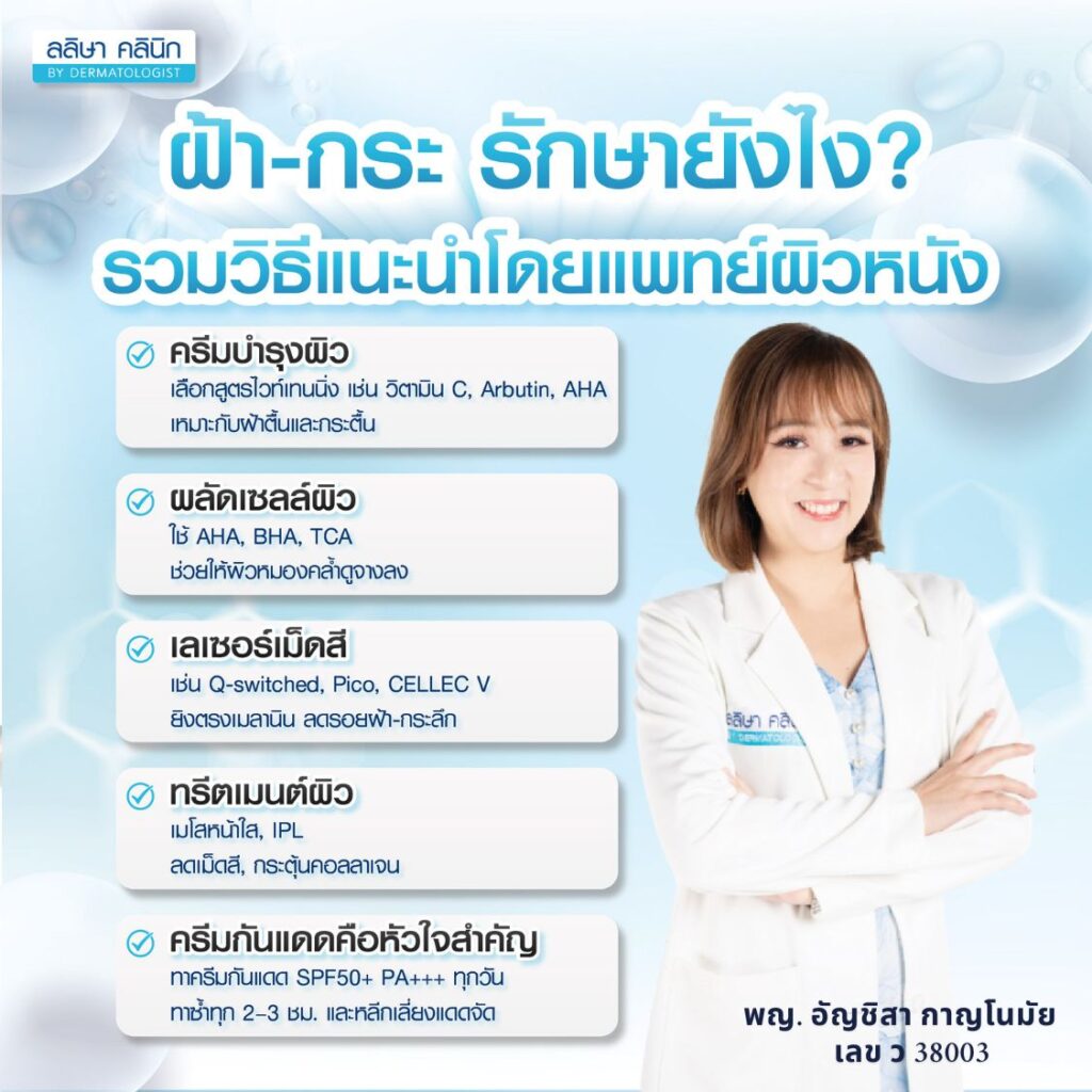วิธีรักษา ฝ้า กระ