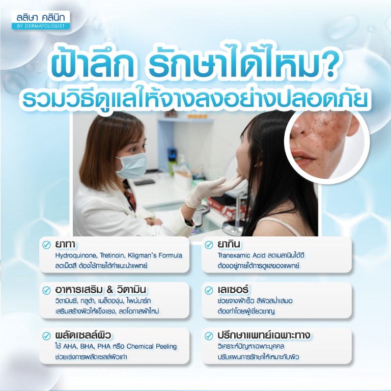 วิธีรักษาฝ้าลึก