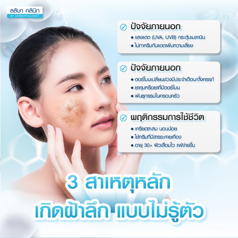 สาเหตุ ฝ้าลึก